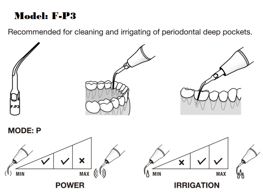 Flight F-P3 Periodontal Scaler Tip | Sub-Gingival Scaling, EMS Piezo Compatible