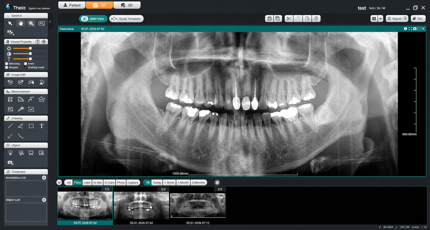 Genoray Papaya 3D Lite Plus | CBCT + Pan + Ceph 16x8 FOV