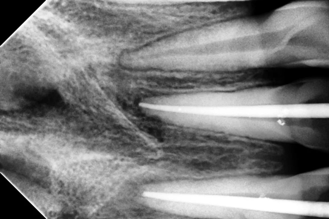 Woodpecker i-Sensor Digital Intra-Oral X-Ray Sensor - H1, H1.5, H2