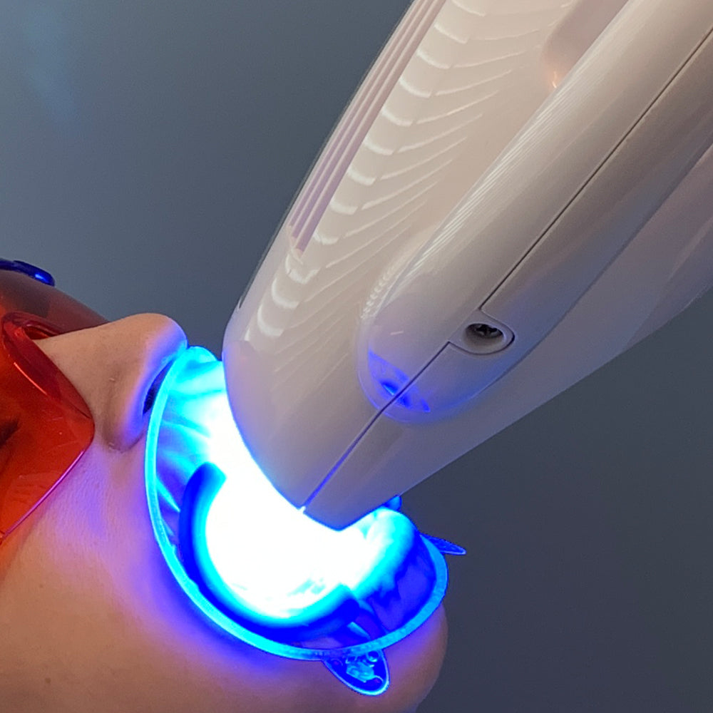 Beyond BlueSeal Gingival Protection – Light-Cured Gum Barrier