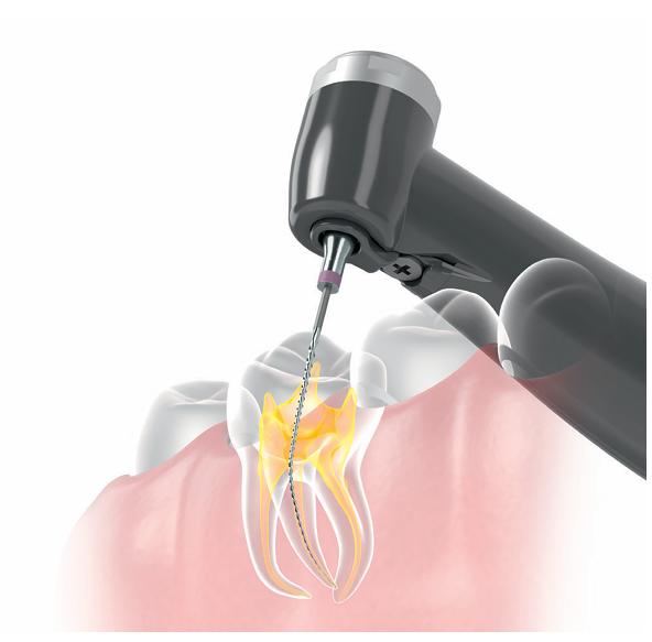 Endodontics