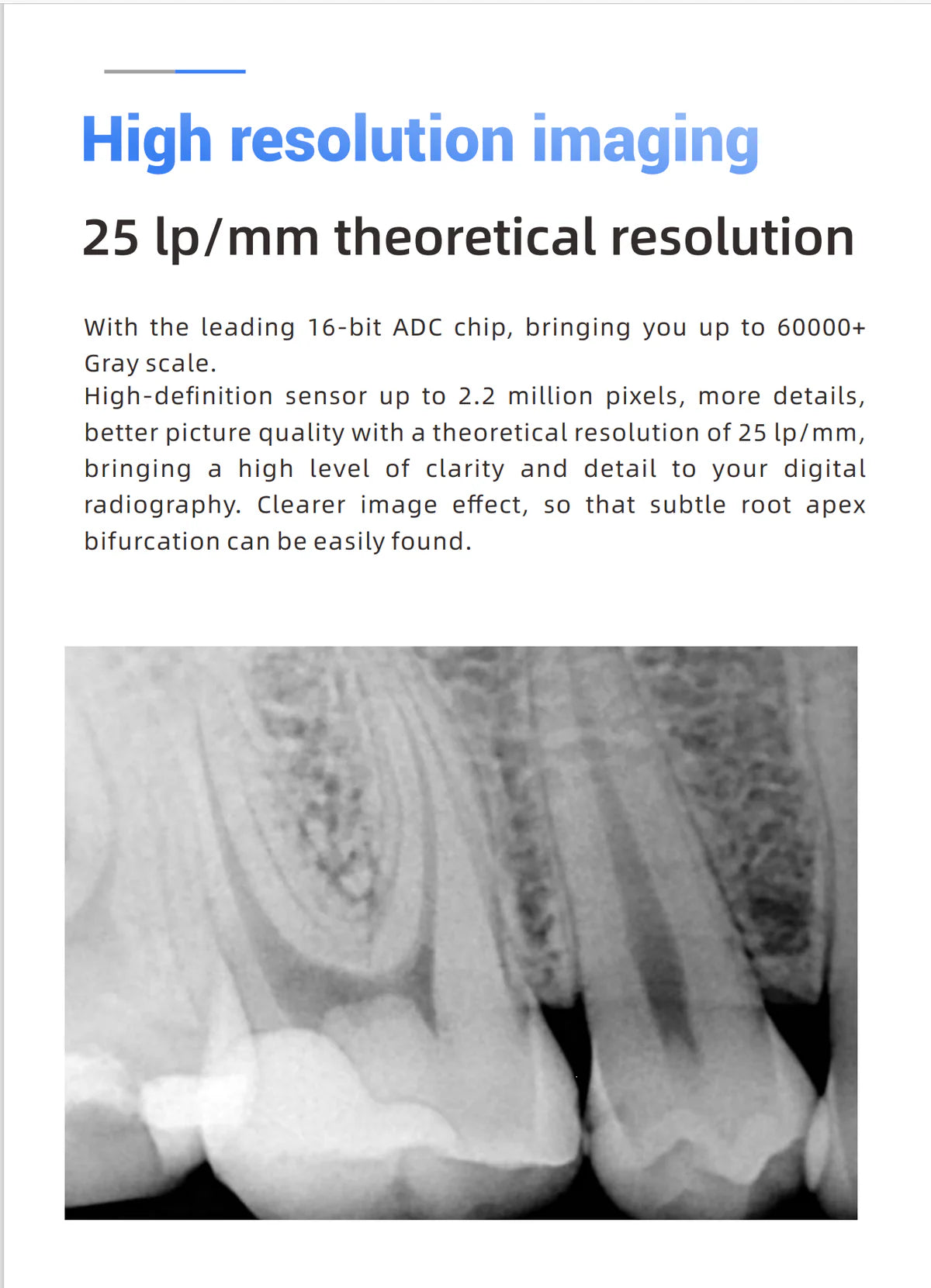 Woodpecker i-Sensor Digital Intra-Oral X-Ray Sensor - H1, H1.5, H2