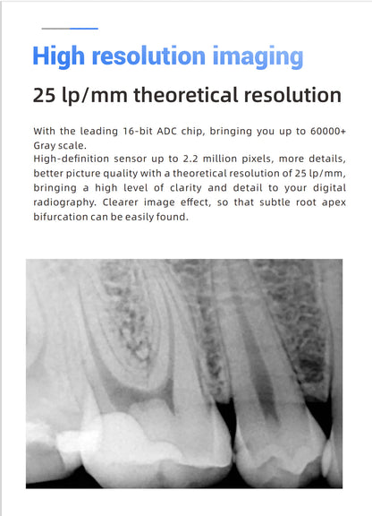 Woodpecker i-Sensor Digital Intra-Oral X-Ray Sensor - H1, H1.5, H2