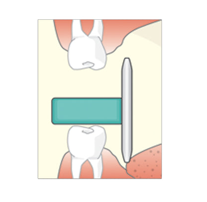 Flow Dental Sticky Bites Blocks for Intra-oral Imaging