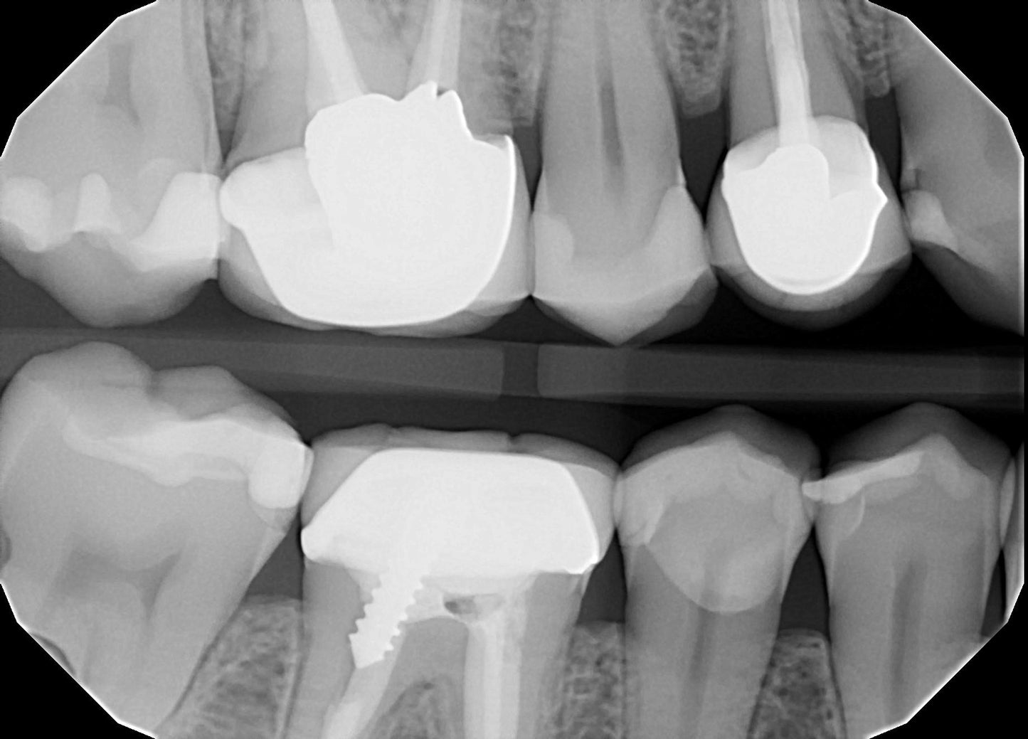 Ecotron DT-703 Handheld Dental X-Ray | 0.3 mm Focal Spot | 70 kV | Free Loaner Program