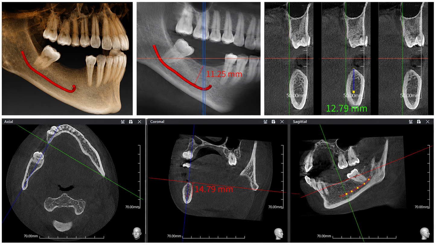 Genoray Papaya 3D Lite | CBCT + Pan 16x8 FOV