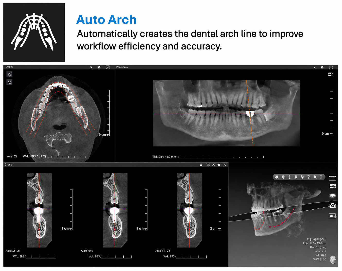 Genoray GT300-C • CBCT + Pan + Ceph • AI-Assisted Dental Imaging System