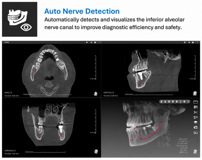 Genoray GT300-C • CBCT + Pan + Ceph • AI-Assisted Dental Imaging System