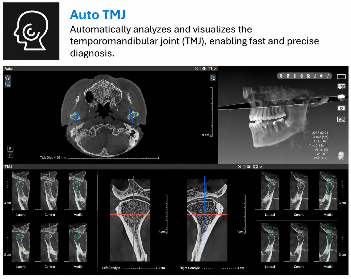 Genoray GT300-C • CBCT + Pan + Ceph • AI-Assisted Dental Imaging System