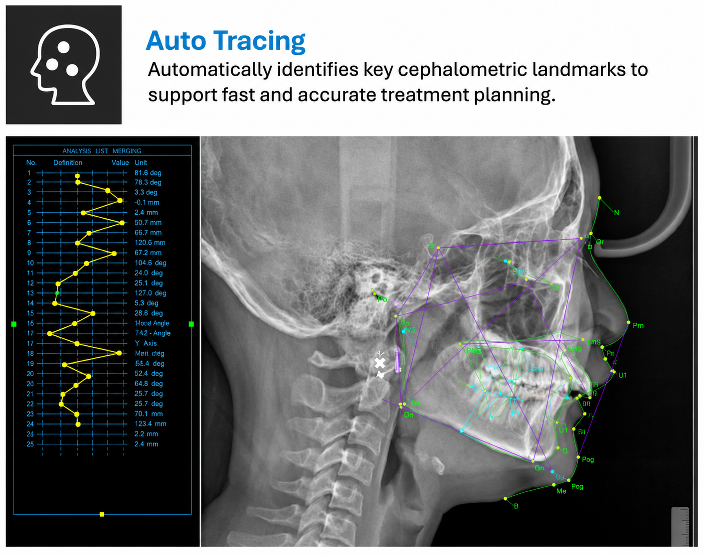 Genoray GT300-C • CBCT + Pan + Ceph • AI-Assisted Dental Imaging System