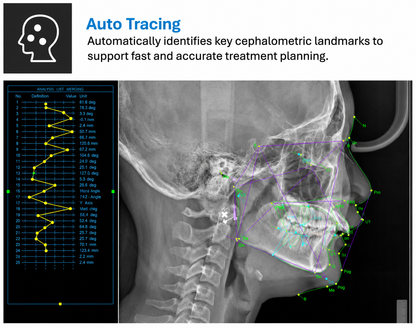 Genoray GT300-C • CBCT + Pan + Ceph • AI-Assisted Dental Imaging System