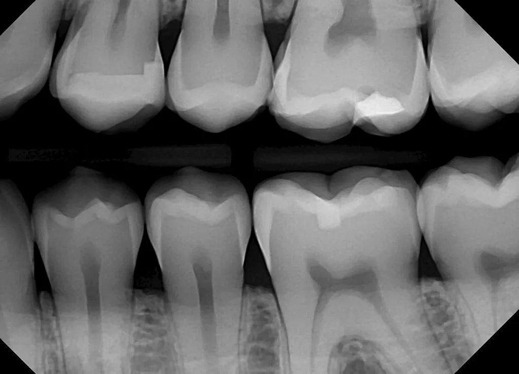 DentiMax DREAM Sensor