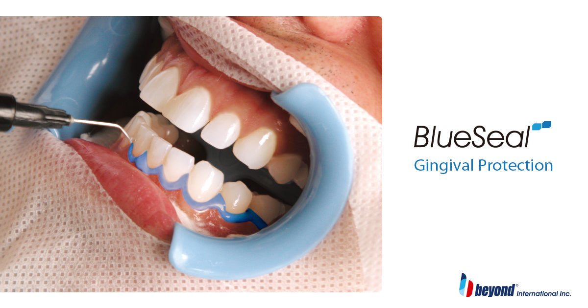 BEYOND BlueSeal Gingival Protection - In Office
