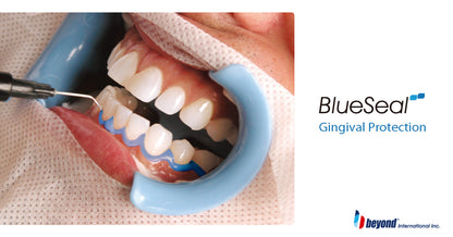 BEYOND BlueSeal Gingival Protection - In Office