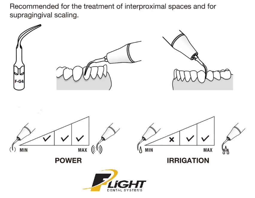 Flight F-G4 General Scaling Tip | Inter-Proximal & Supra-Gingival, EMS Piezo Compatible
