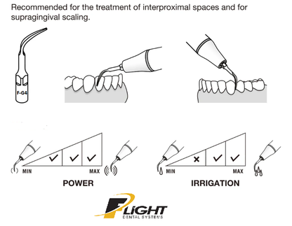 Flight F-G4 General Scaling Tip | Inter-Proximal & Supra-Gingival, EMS Piezo Compatible