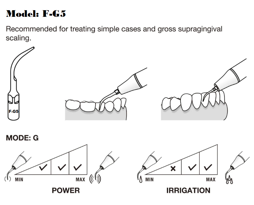 Flight F-G5 General Scaling Tip | Gross Supra-Gingival Scaling, EMS Piezo Compatible