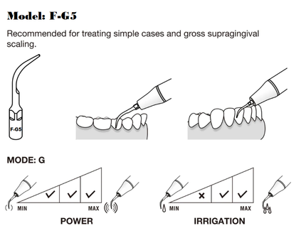 Flight F-G5 General Scaling Tip | Gross Supra-Gingival Scaling, EMS Piezo Compatible