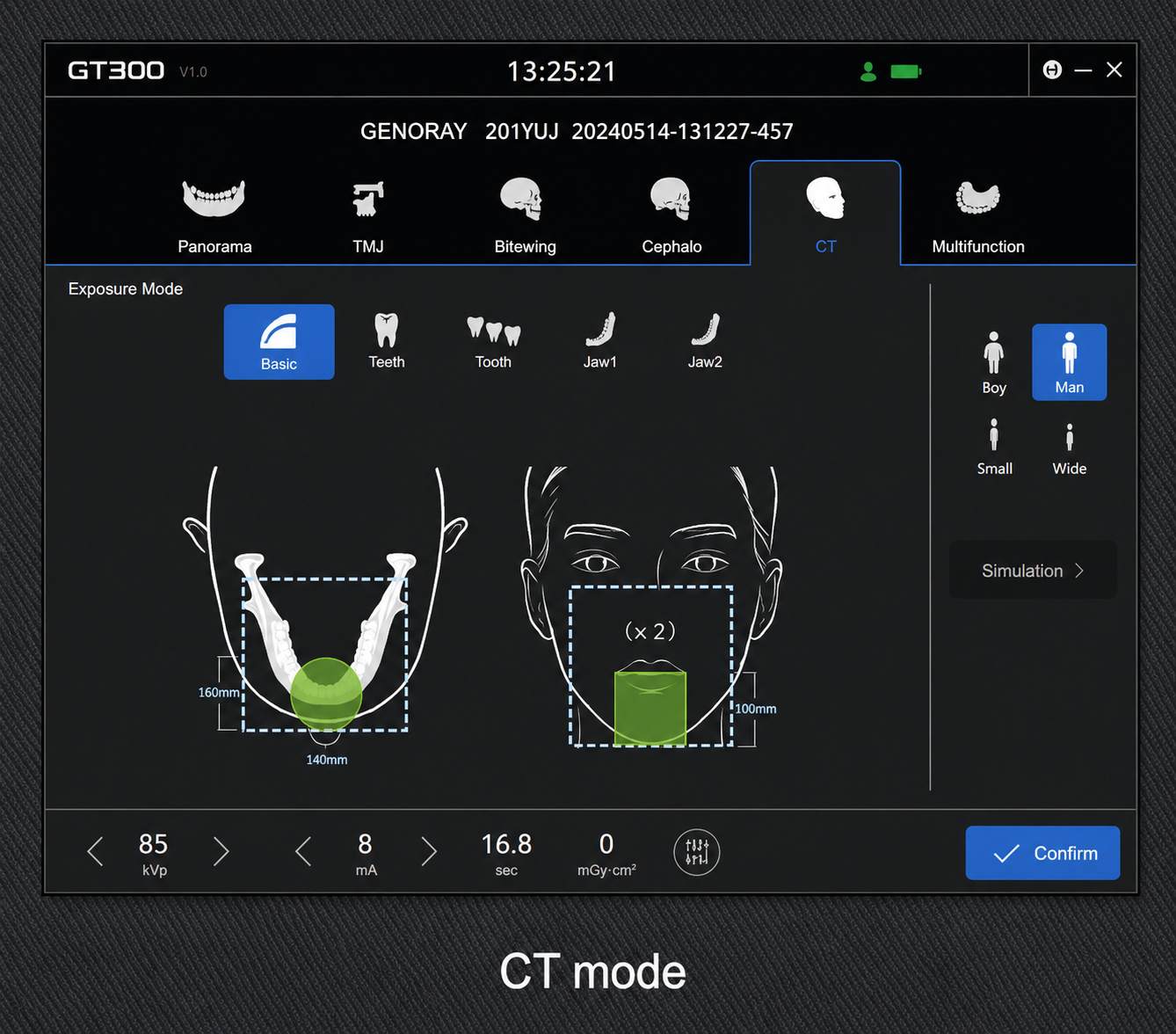 Genoray GT300-C • CBCT + Pan + Ceph • AI-Assisted Dental Imaging System
