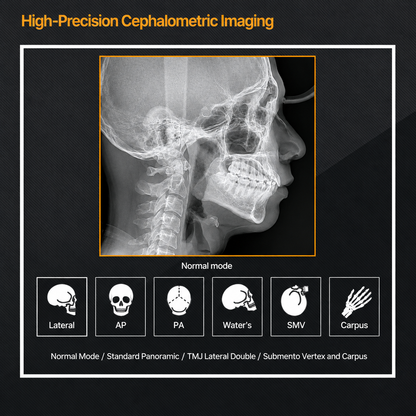 Genoray GT300-C • CBCT + Pan + Ceph • AI-Assisted Dental Imaging System