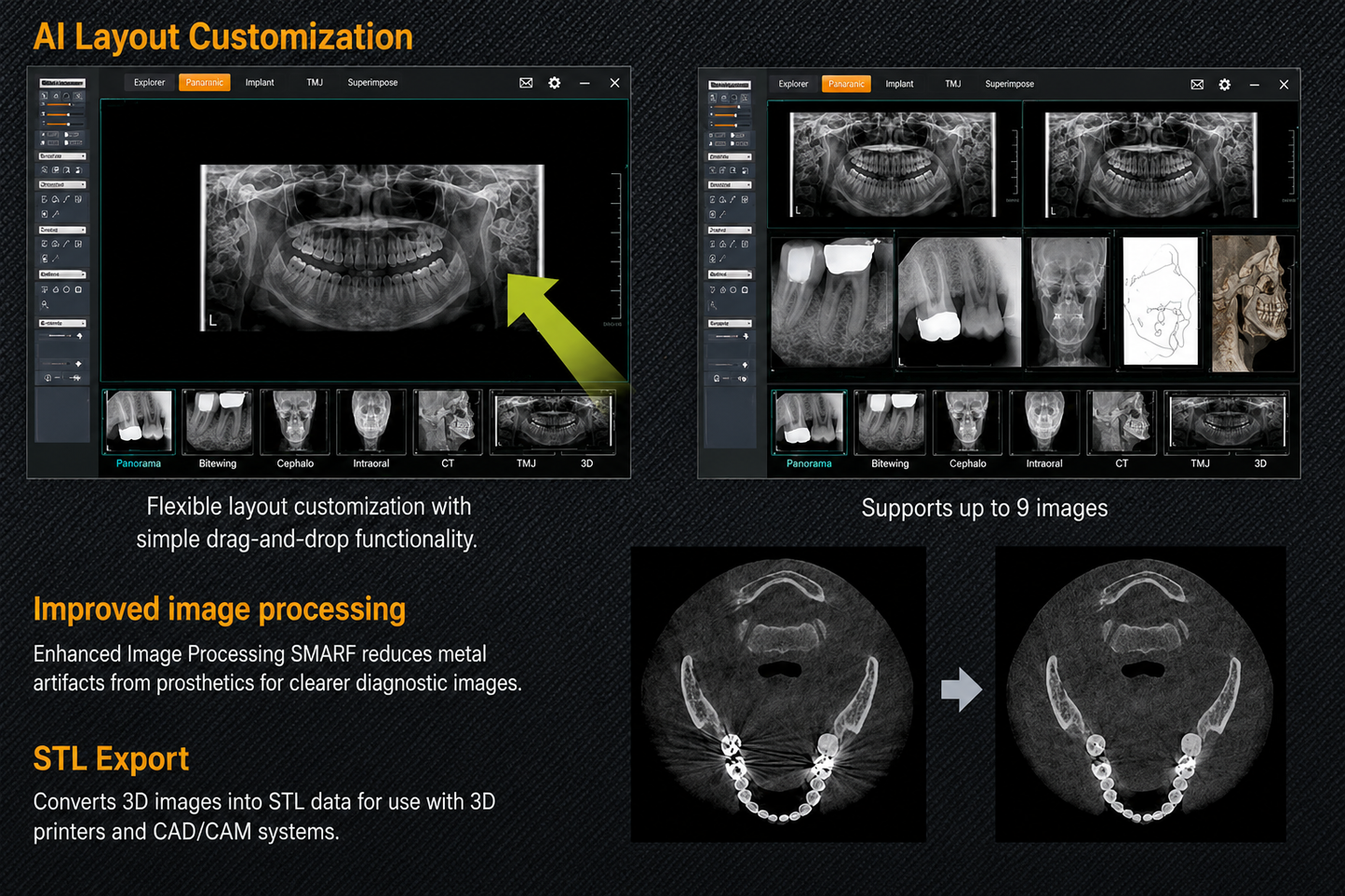 Genoray GT300-C • CBCT + Pan + Ceph • AI-Assisted Dental Imaging System