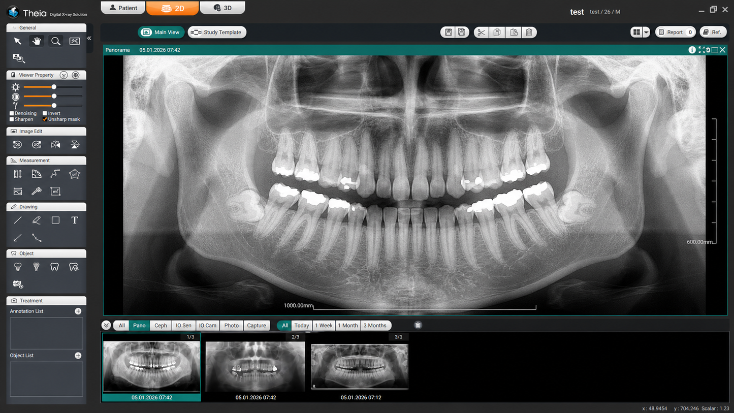 Genoray Papaya 3D Lite | CBCT + Pan 16x8 FOV