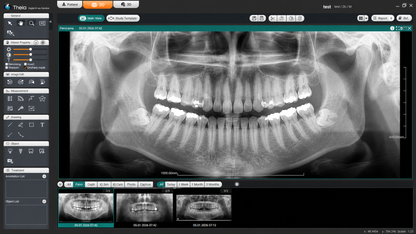 Genoray Papaya 3D Lite | CBCT + Pan 16x8 FOV