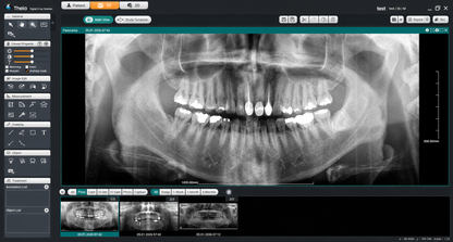 Genoray Papaya 3D Lite | CBCT + Pan 16x8 FOV
