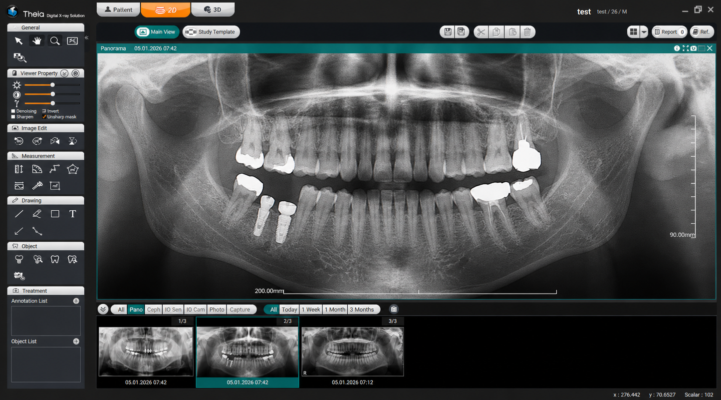 Genoray Papaya 3D Lite | CBCT + Pan 16x8 FOV