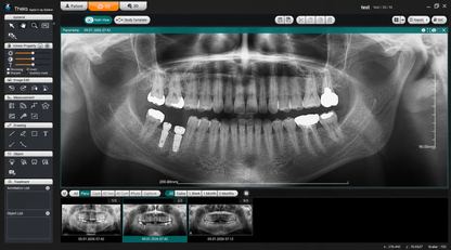 Genoray Papaya 3D Lite | CBCT + Pan 16x8 FOV