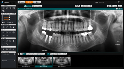 Genoray Papaya 3D Premium Plus | CBCT + Pan + Ceph + 3D Model Scanning 16x14 FOV