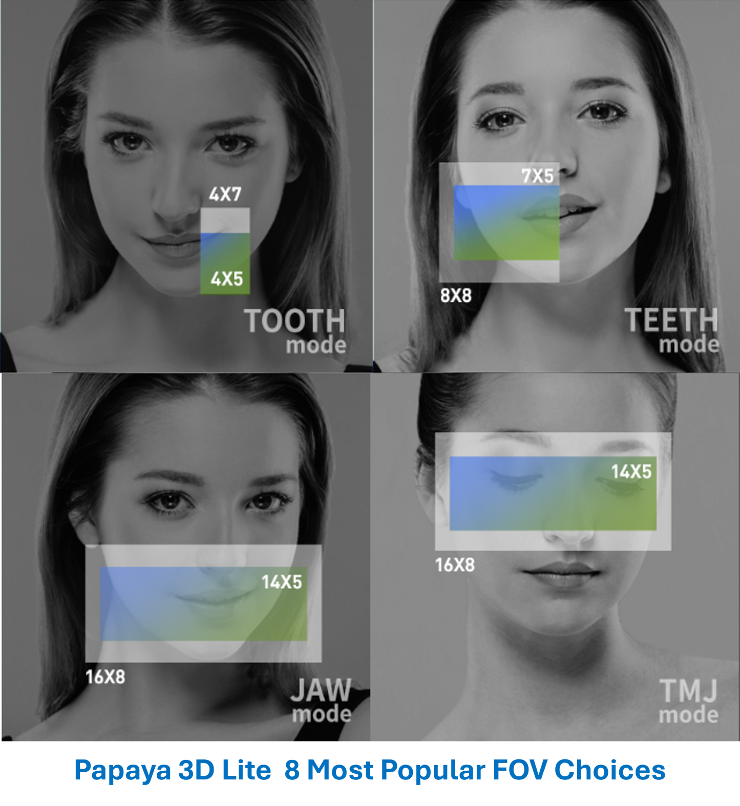 Genoray Papaya 3D Lite | CBCT + Pan 16x8 FOV