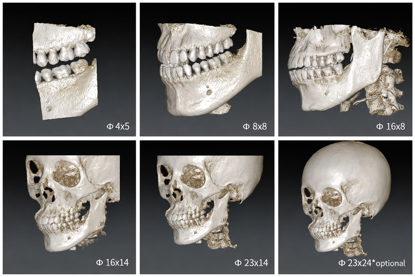 Genoray Papaya 3D Premium Plus | CBCT + Pan + Ceph + 3D Model Scanning 16x14 FOV