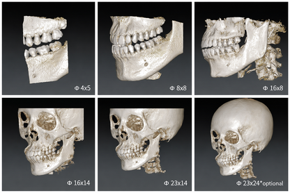Genoray Papaya 3D Premium Plus | CBCT + Pan + Ceph + 3D Model Scanning 16x14 FOV