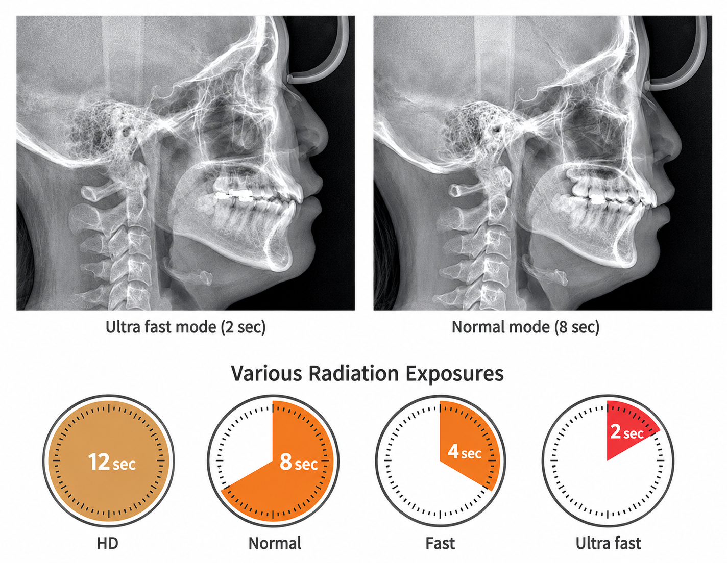 Genoray Papaya 3D Premium Plus | CBCT + Pan + Ceph + 3D Model Scanning 16x14 FOV