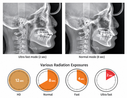 Genoray Papaya 3D Premium Plus | CBCT + Pan + Ceph + 3D Model Scanning 16x14 FOV