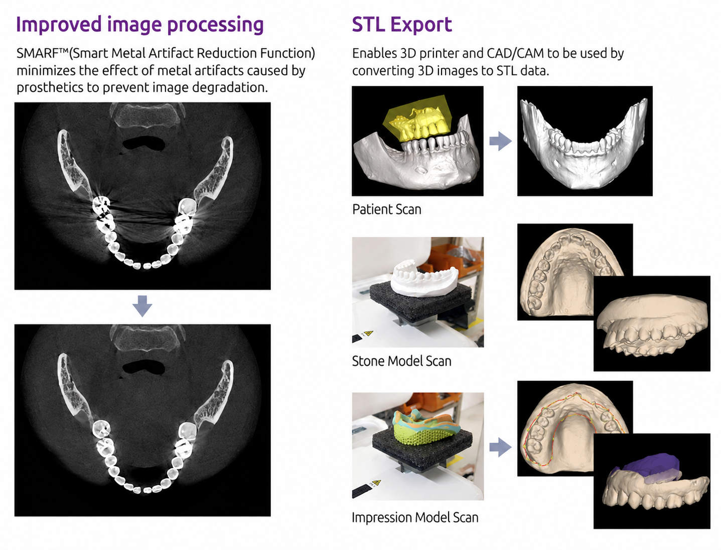 Genoray Papaya 3D Premium Plus | CBCT + Pan + Ceph + 3D Model Scanning 16x14 FOV