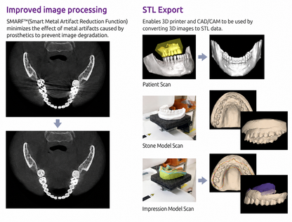 Genoray Papaya 3D Premium Plus | CBCT + Pan + Ceph + 3D Model Scanning 16x14 FOV