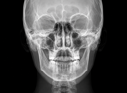 Genoray Papaya 3D Lite Plus | CBCT + Pan + Ceph 16x8 FOV