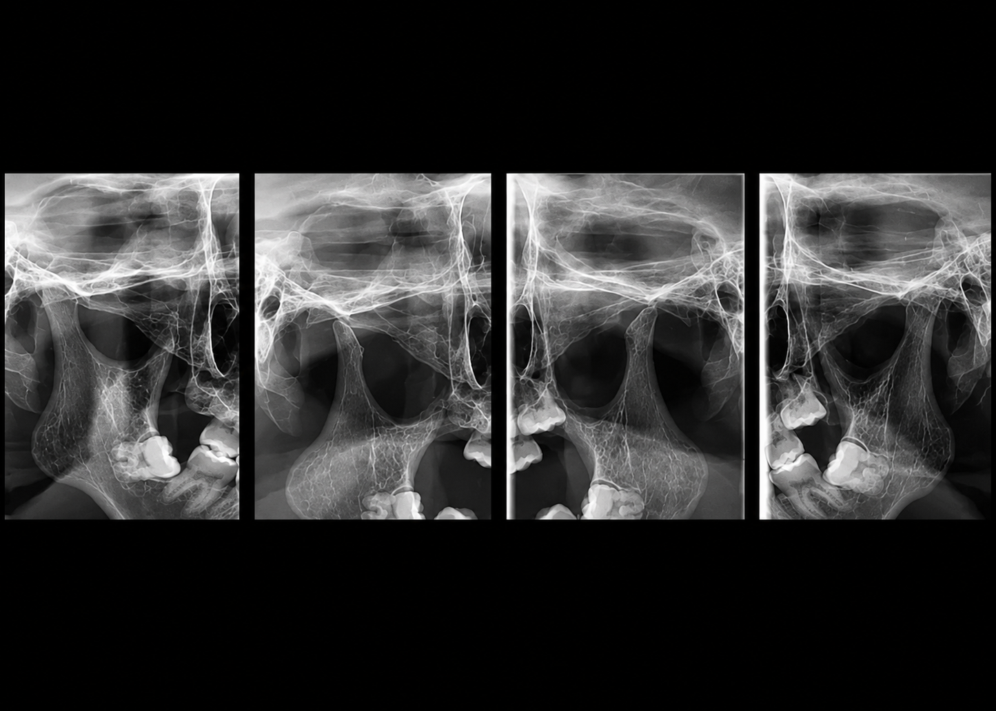 Genoray Papaya 3D Premium Plus | CBCT + Pan + Ceph + 3D Model Scanning 16x14 FOV