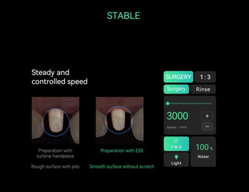 Woodpecker ES5 Electric Surgical Motor w/ 1:5 & 1:3 Handpieces