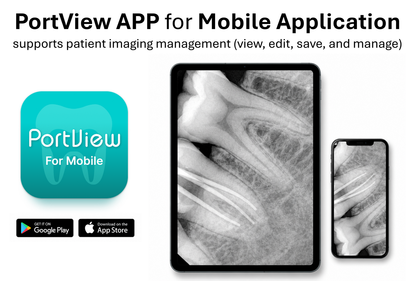 Genoray ZEN-PX4 Remote Dentistry Handheld X-Ray | Imaging Anywhere on Earth