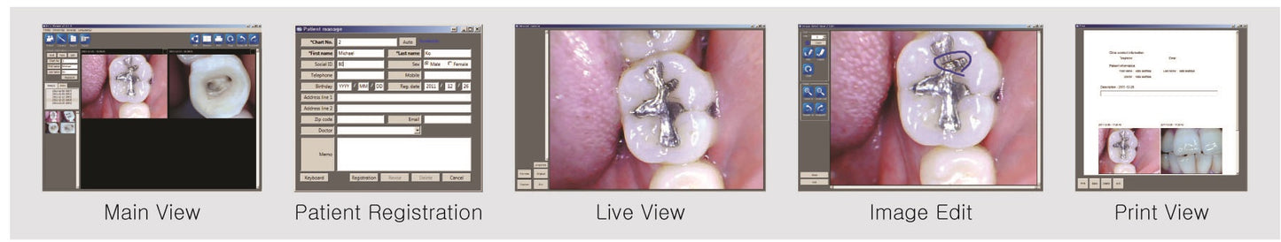 Flight Whicam Story 3 Wireless Intraoral Camera | Cordless Chairside Imaging