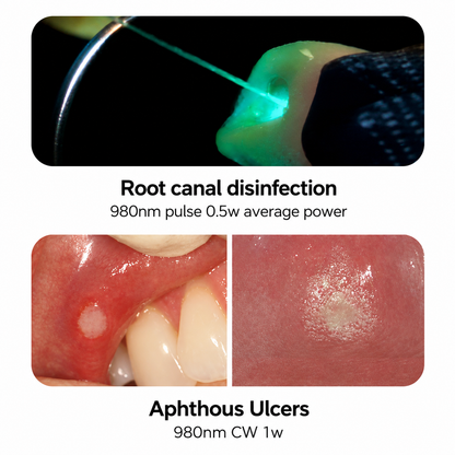 PIOON UTU G7 Triple-Wavelength Dental Diode Laser 450nm/650nm/980nm | 7W
