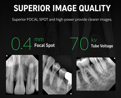 Genoray ZEN PX4e Handheld Dental X-Ray System