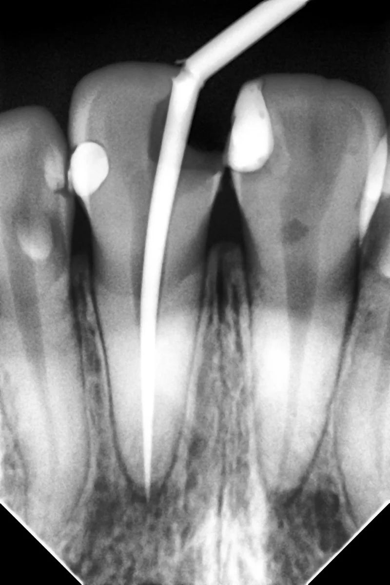 Woodpecker i-Sensor Digital Intra-Oral X-Ray Sensor - H1, H1.5, H2